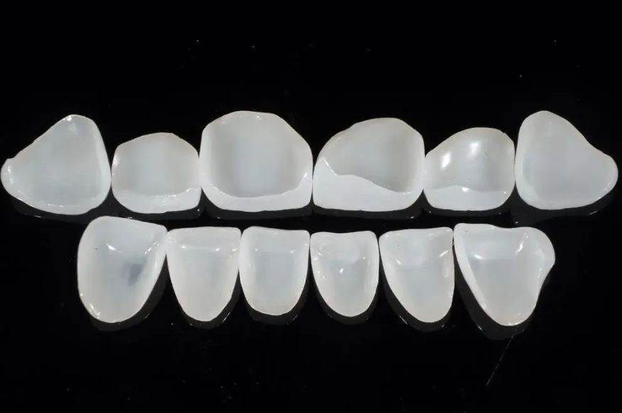 Do porcelain veneers fall off easily?