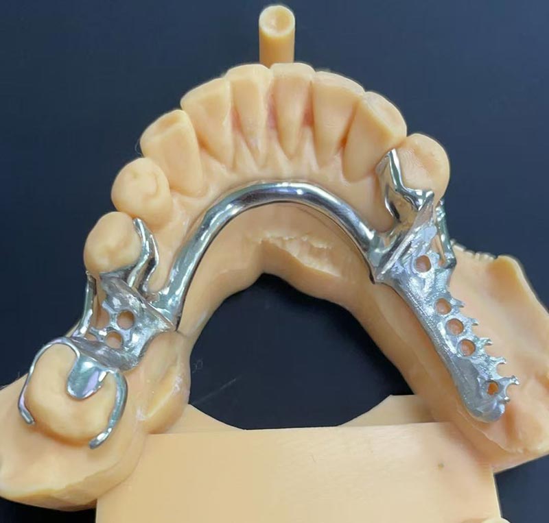 Предности оквира Цобалт-Цхромиум (Цо Цр Фрамеворк)