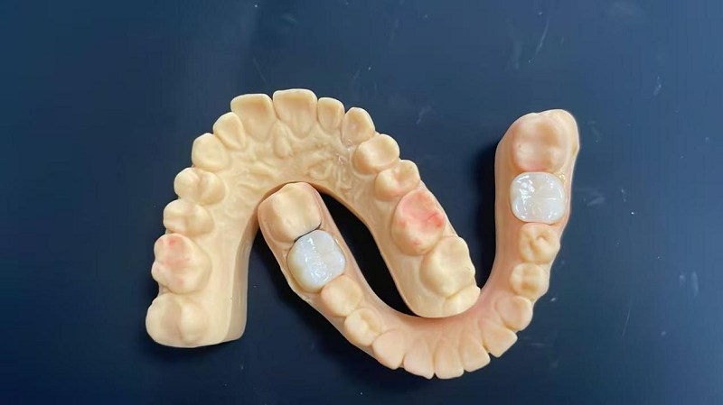 Шта је ивица рамена?