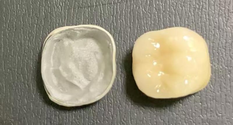 ВМ ДЕНТАЛ ЛАБ – Водећа кинеска стоматолошка лабораторија