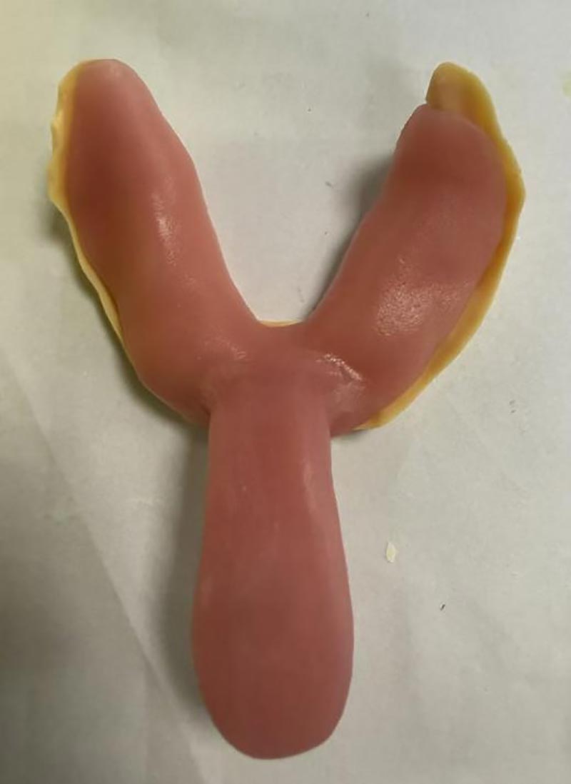 Ствари које нисте знали о прилагођеним носачима за зубе